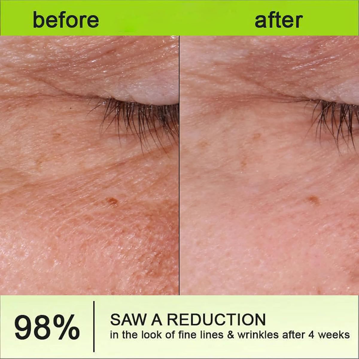 Lumenea Retinal Tightening Serum